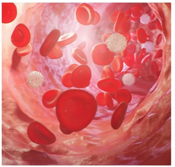 Haematology and BMT